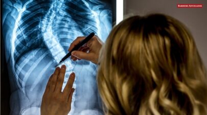 Escoliose aposenta pelo INSS? Saiba tudo